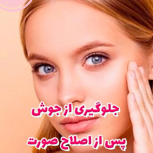 جلوگیری از جوش پس از اصلاح صورت