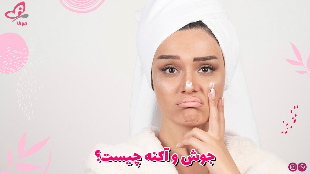جوش و آکنه چیست؟