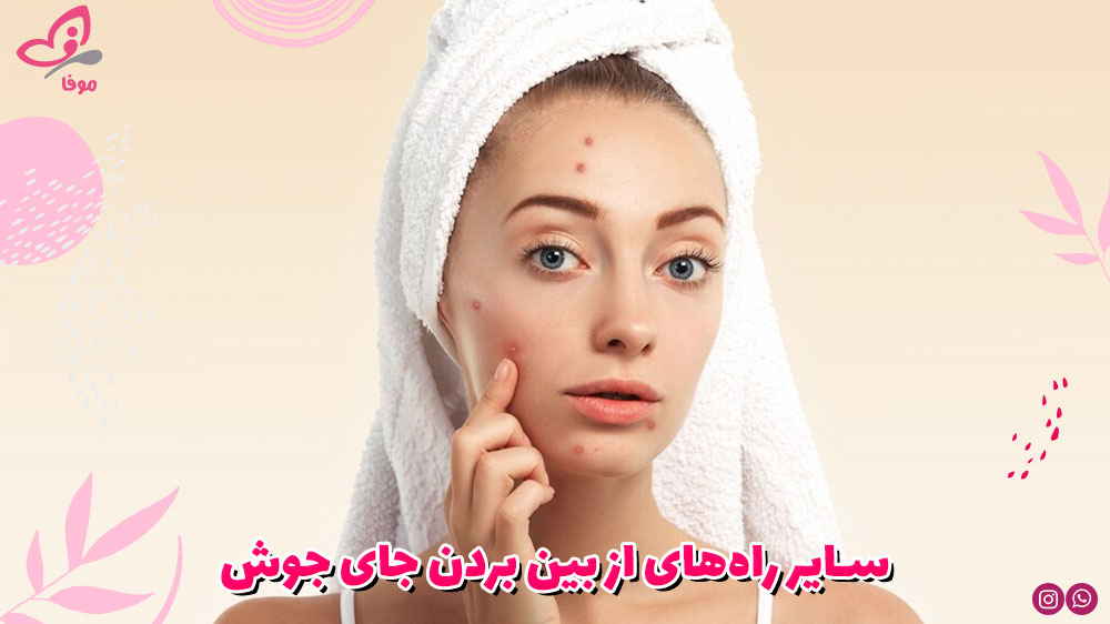 سایر راههای از بین بردن جای جوش